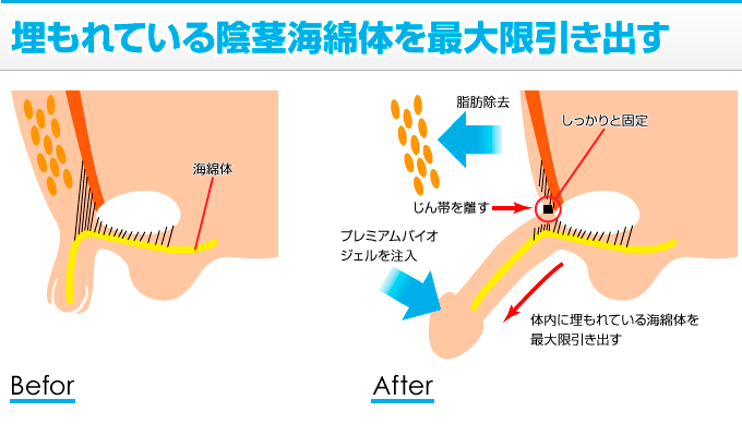 でかいちんこの基準とは？日本人平均や大きくする方法を解説 |【公式】ユナイテッドクリニック