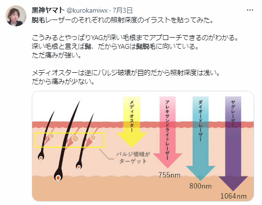 包茎ちんちんのおしっこと射精　日本人男子