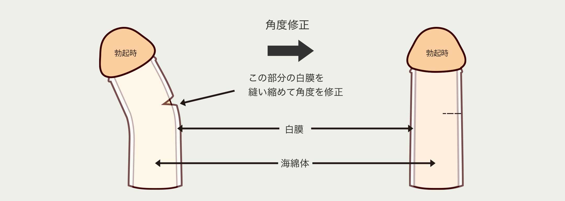 日帰り手術｜ささきクリニック｜草津駅徒歩5分の小児外科・小児科・外科