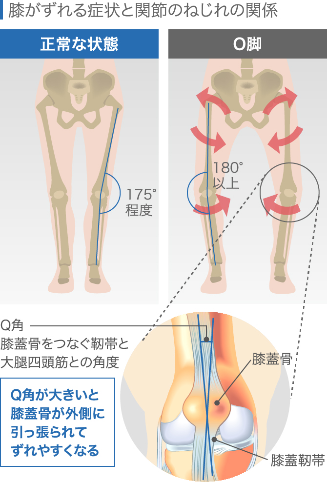 ひざ 膝 関節 サプリ フィッシュゼラチン