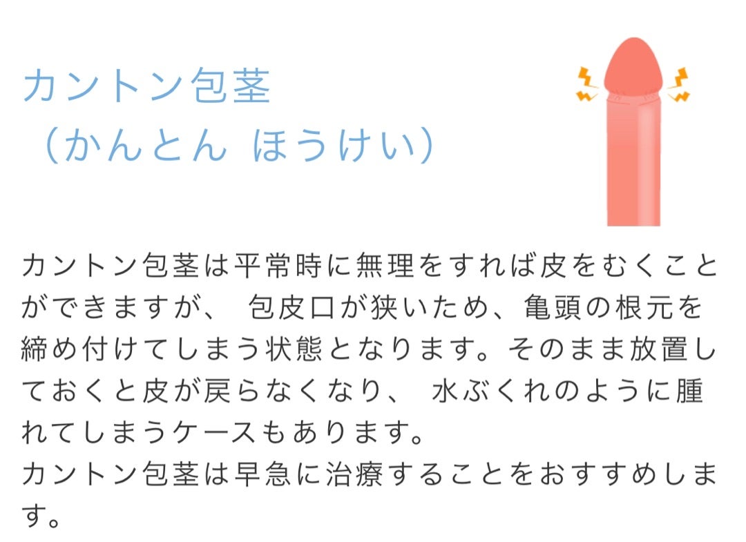 切らない包茎手術ってどういう事？ – メンズ形成外科 | 青山セレス&船橋中央クリニック