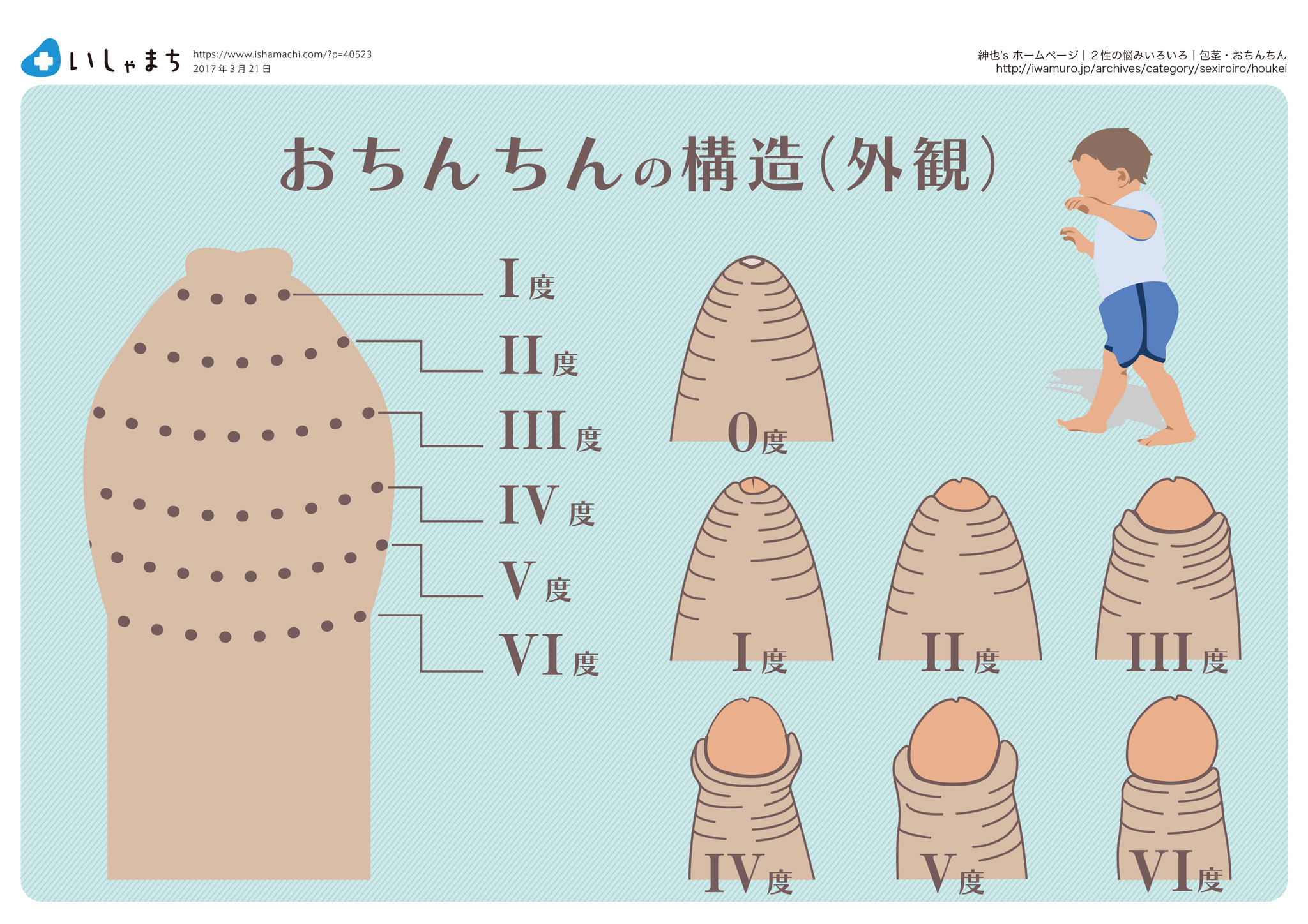 半数以上の女性は「包茎は臭い」と知っている｜包茎手術のことなら包茎治療ナビゲーター